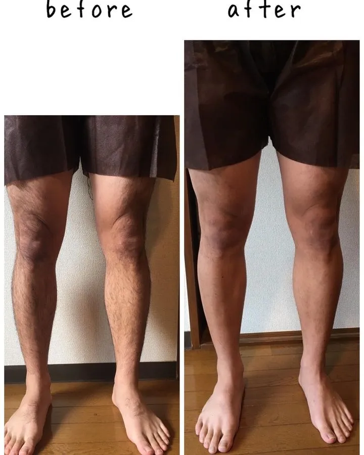 施術事例